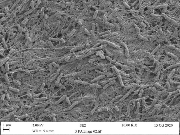 Jane Wood - Bacterial cellulose x 10k magnification